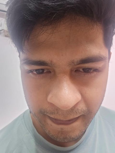 Spot Fade Advanced Repair Serum