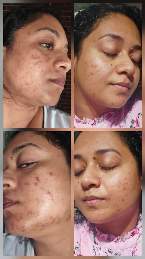 Rapid Clear Facewash