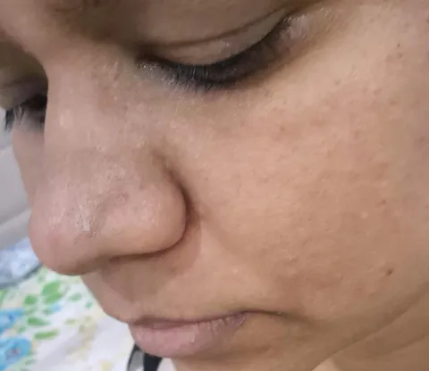 Rapid Clear Facewash