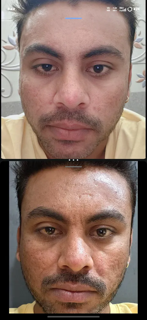 Spot Fade Advanced Repair Serum