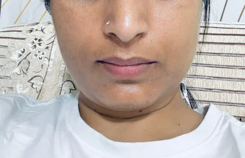 Rapid Clear Facewash