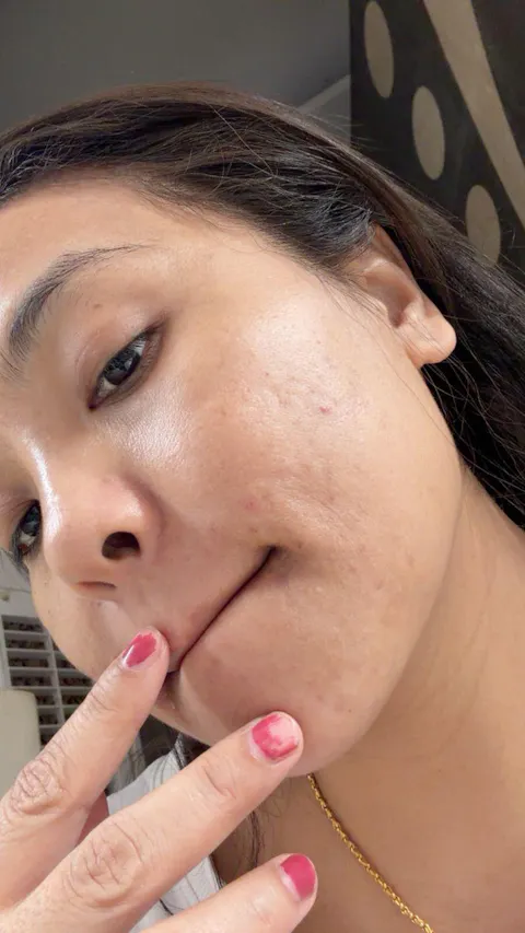 Rapid Clear Facewash