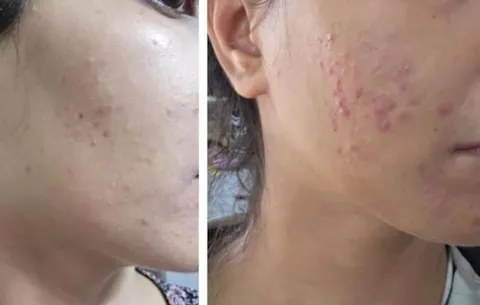 Rapid Clear Facewash