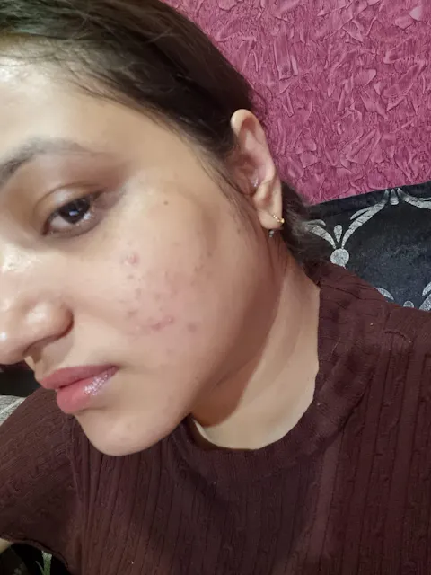 Rapid Clear Facewash