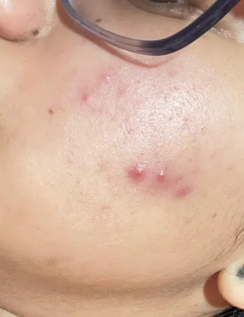 Rapid Clear Facewash