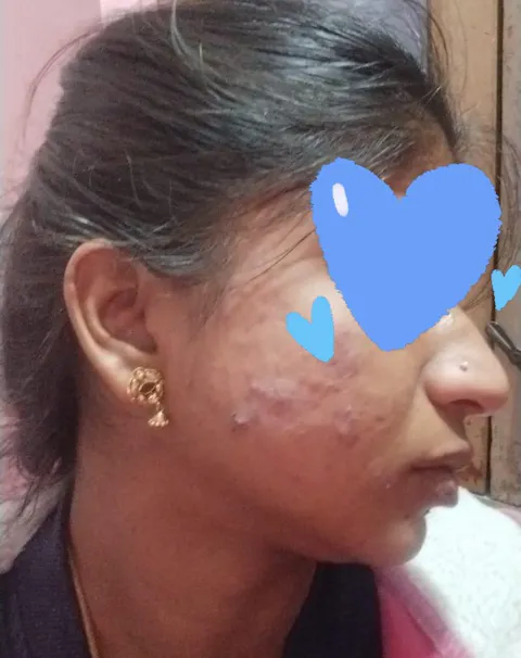 Rapid Clear Facewash