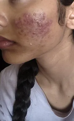 Review picture