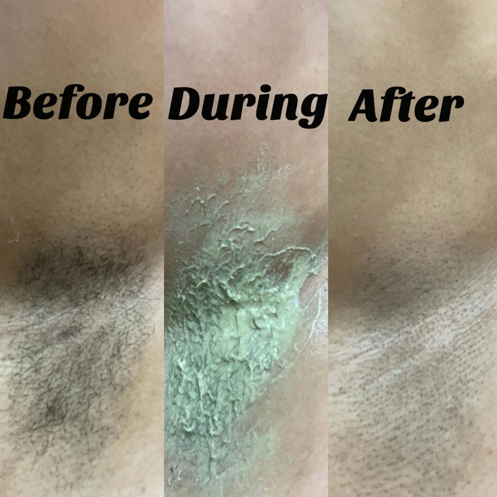 Spearmint and Matcha Hair Removal