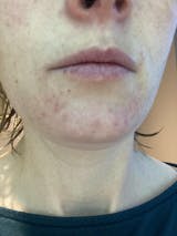 Wild Crafted Repair Balm