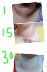 Hypo-Thyroid Care Bundle