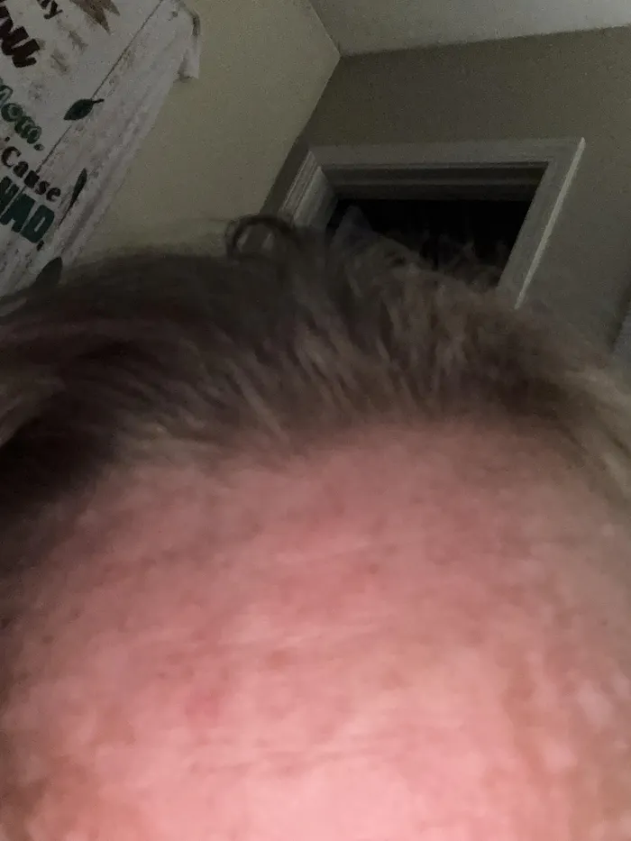 HerbaBloom customer scalp and hair review