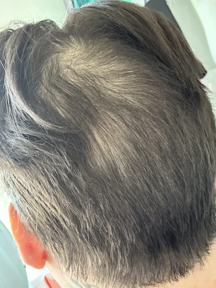 HerbaBloom customer fuller hair review