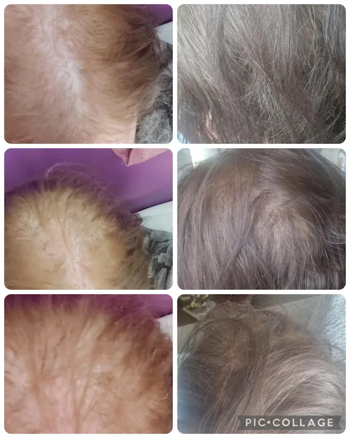 HerbaBloom customer hair review