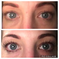 Uklash Eyelash Growth Serum for Longer, Fuller and Healthier Lashes ...