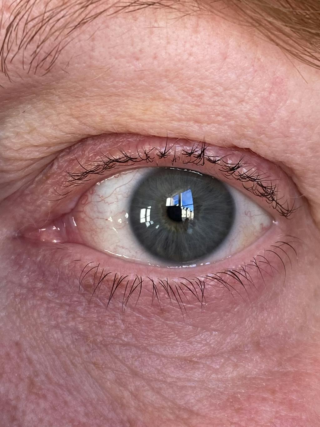 Uklash Eyelash Growth Serum for Longer, Fuller and Healthier Lashes