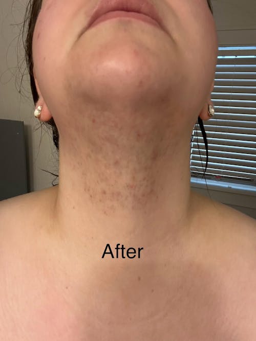 Hair Reducing Fade Oil - Slows Growth, Thins, and Reduces Hair Naturally