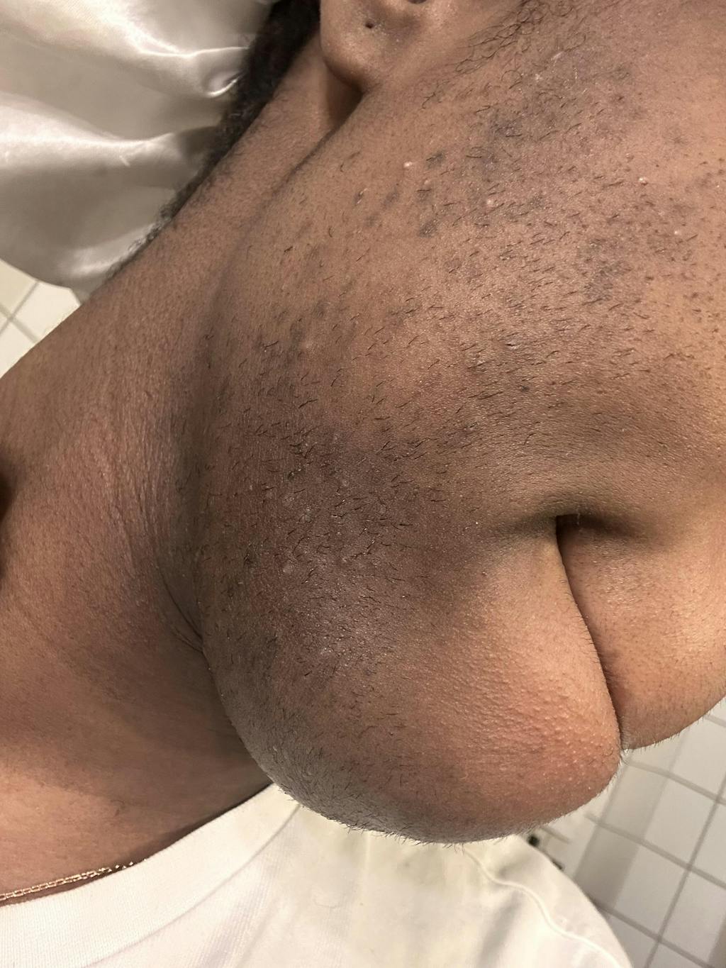 Hair Reducing Fade Oil - Slows Growth, Thins, and Reduces Hair Naturally