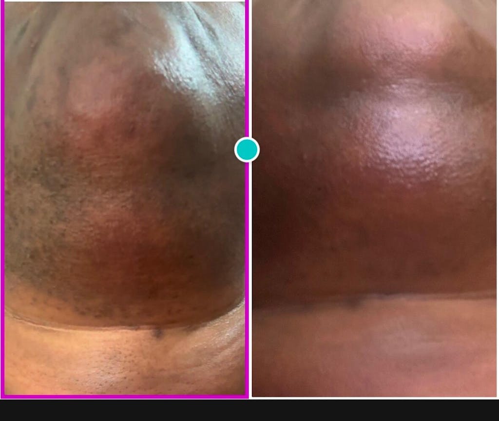 Hair Reducing Fade Oil - Slows Growth, Thins, and Reduces Hair Naturally