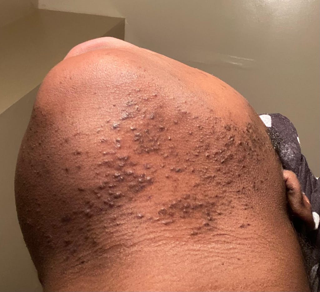 Hair Reducing Fade Oil - Slows Growth, Thins, and Reduces Hair Naturally