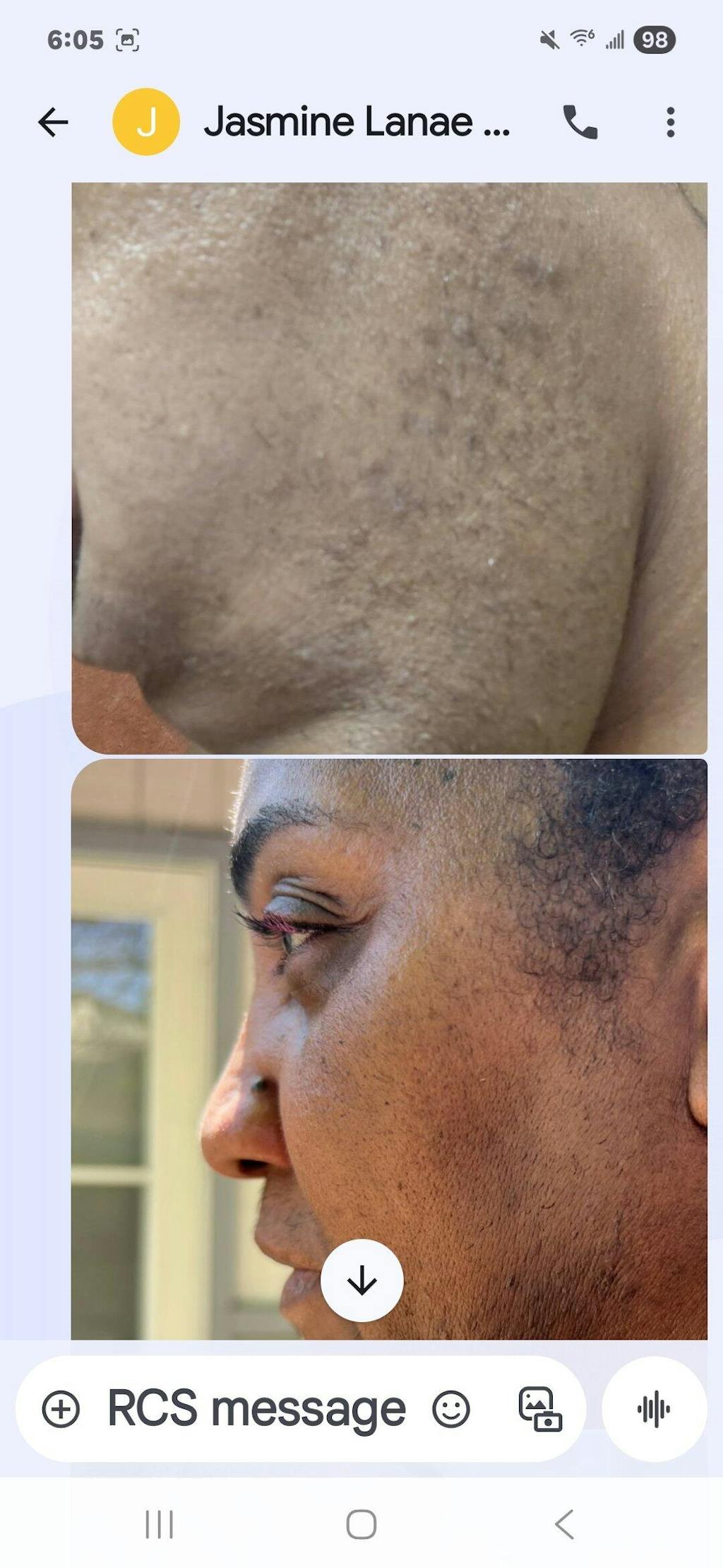 Facial Moisturizer (Ingrown Hair/Acne)