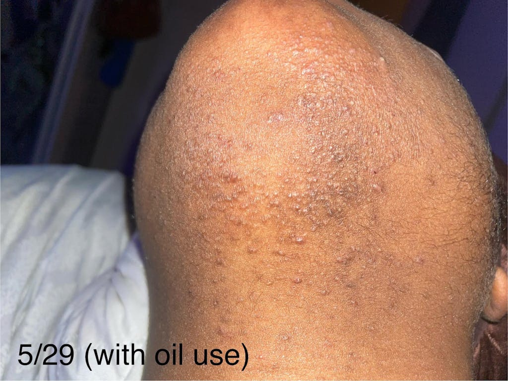 Hair Reducing Fade Oil - Slows Growth, Thins, and Reduces Hair Naturally