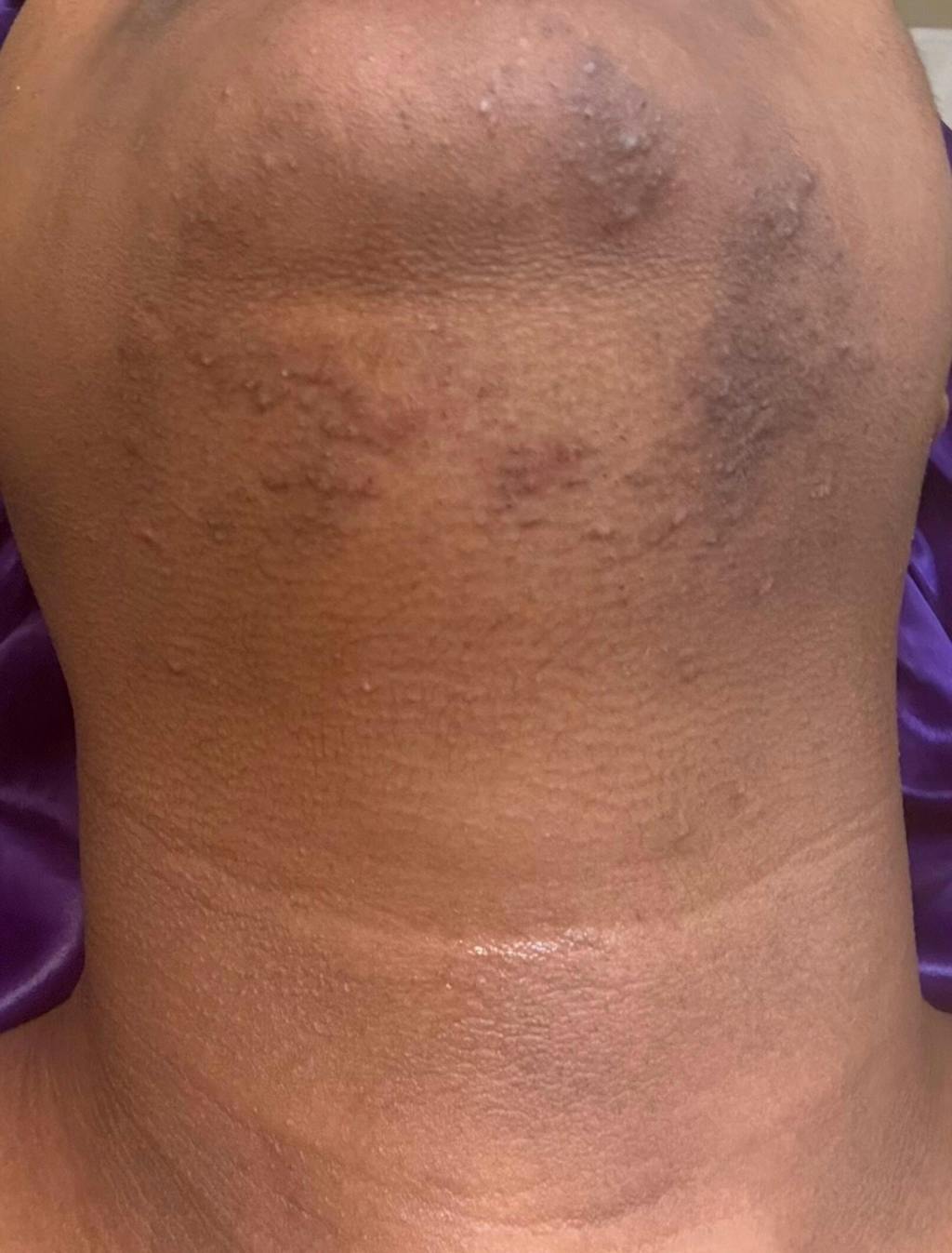 Hair Reducing Fade Oil - Slows Growth, Thins, and Reduces Hair Naturally