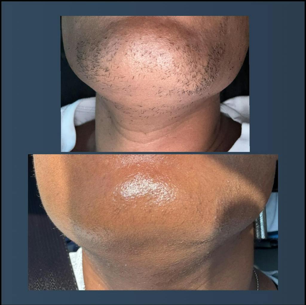 Hair Reducing Fade Oil - Slows Growth, Thins, and Reduces Hair Naturally