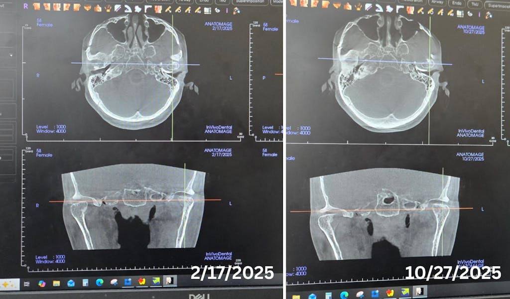 [3-Month Supply] Bone health Bio-Calcium Micellar Cream