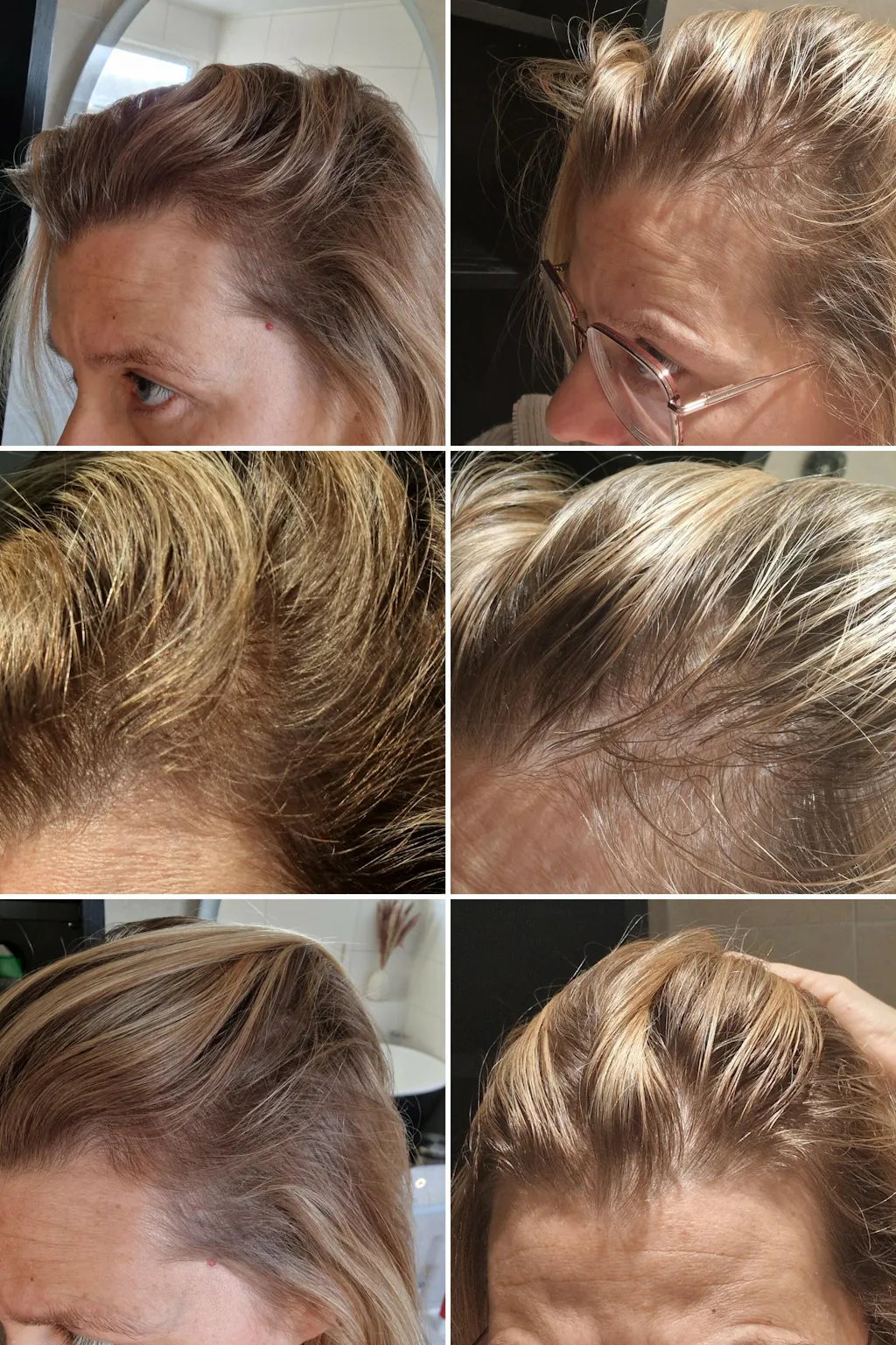 Hårväxt Kit – Naturens Kraft mot Tunt Hår – Under Your Skin Sweden