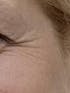 Rejuvenation Serum Intense Skin Treatment