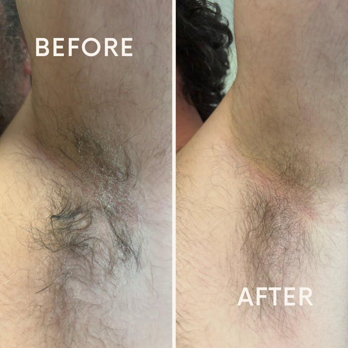 Underarm Cleanser