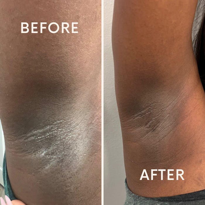 Underarm Cleanser