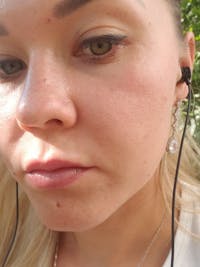 LED Neck Wrinkle Remover™ Deluxe