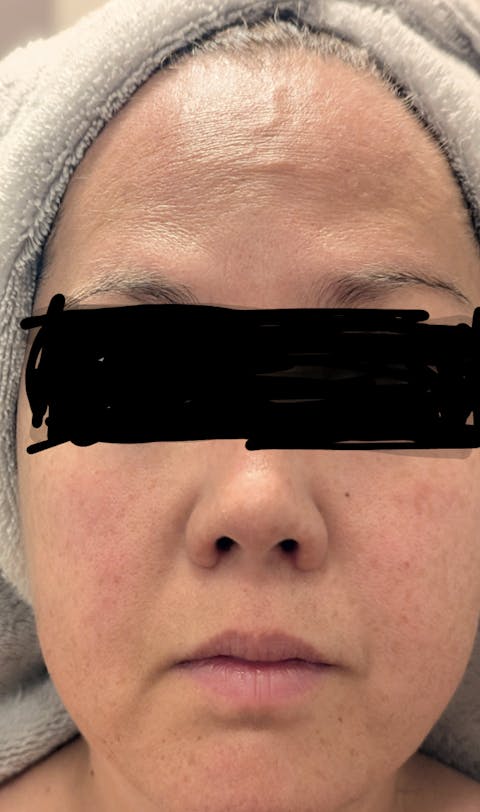 NiaBoost Radiance Serum