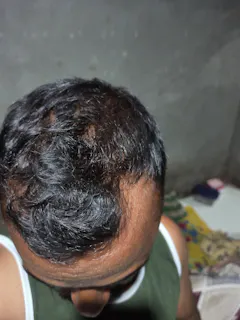 Review picture