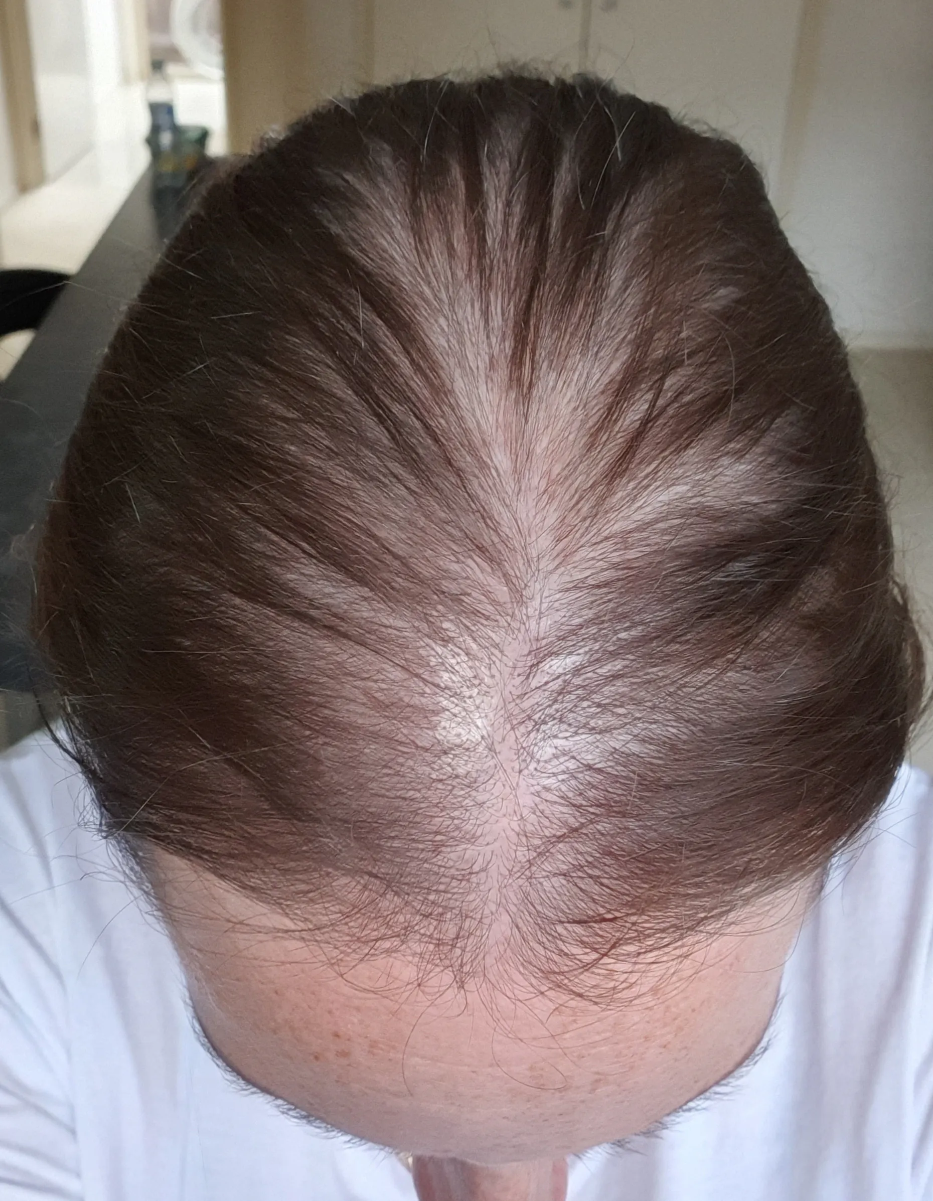 Best Hair Growth Shampoo & Conditioner Australia Watermans Hair