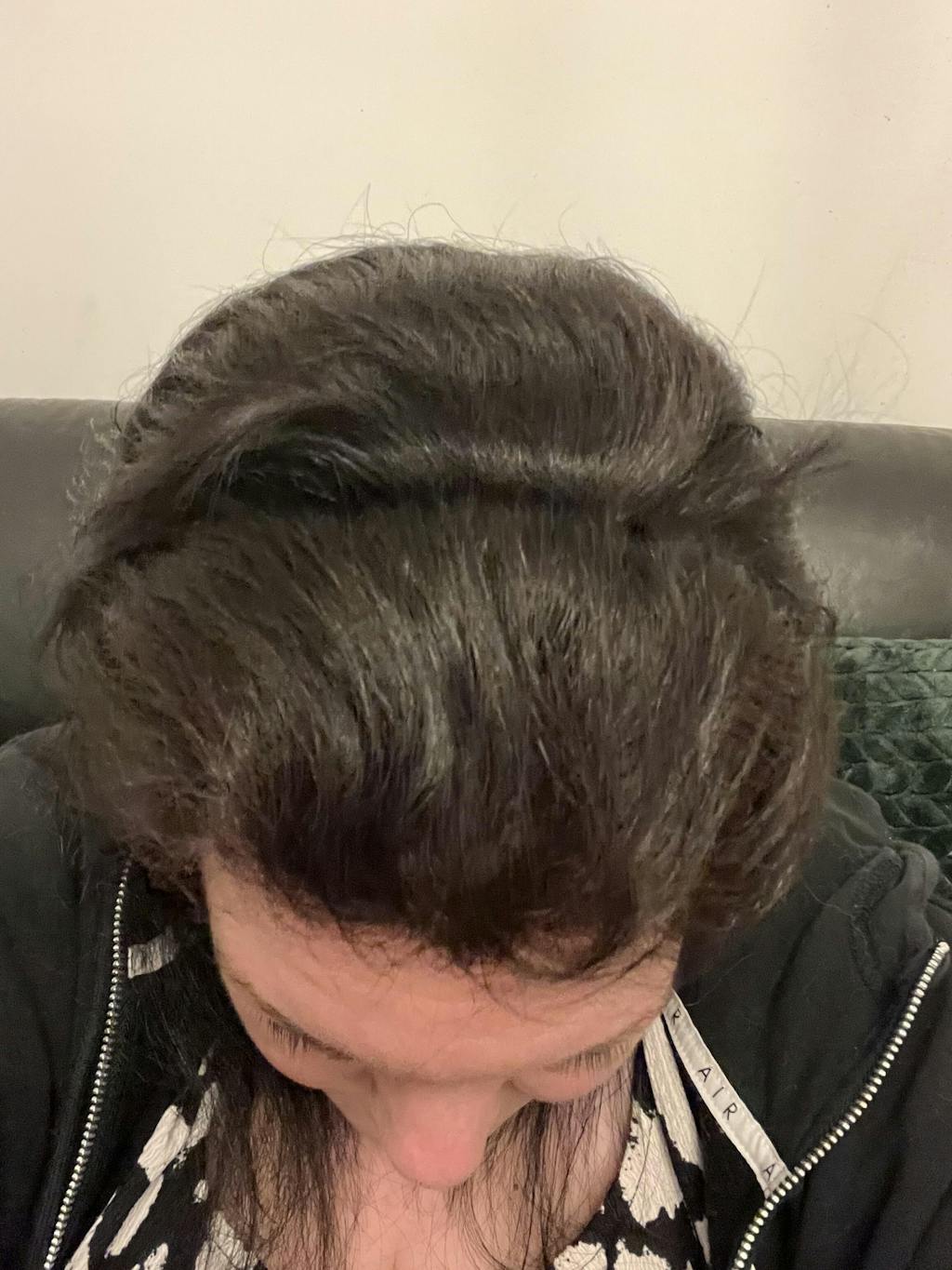 Watermans Hair Growth Shampoo and Conditioner set for women and men.