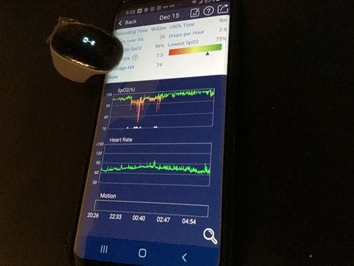 Wellue O2Ring Pulse Oximeter. In Stock. Continuously Track Overnight