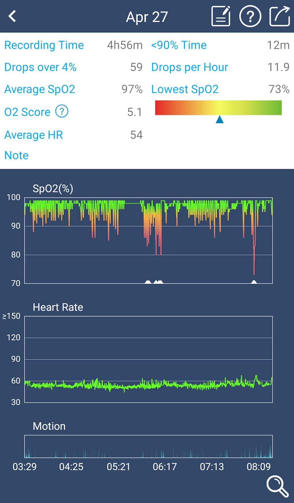Wellue O2Ring™ Continuous Ring Oxygen Monitor. Continuously Track