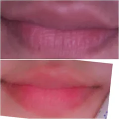 Review picture