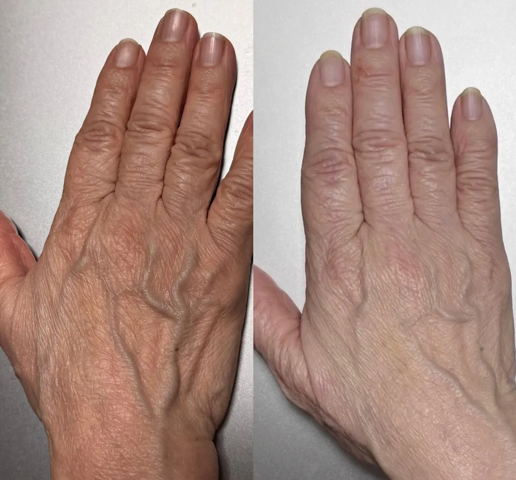 WINGLOW 炭酸ペースト　トライアルサイズ