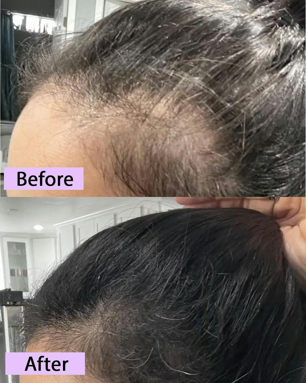 WishCare Hair Growth Serum | 3% Redensyl + 4% Anagain