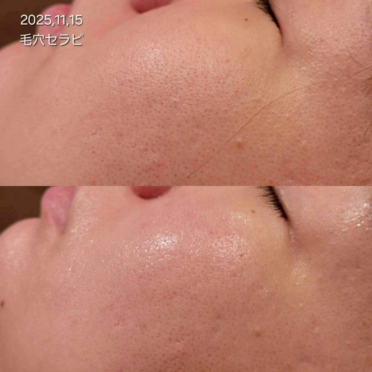 セラピール」とは – XE`LHA Japan