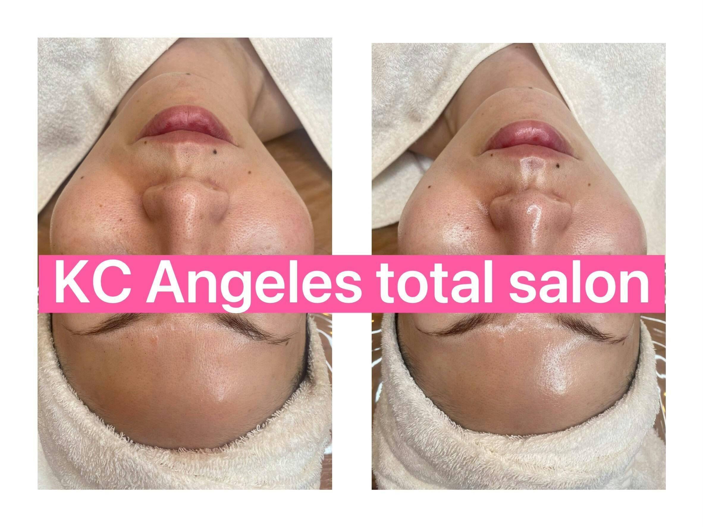 セラピール」とは – XE`LHA Japan