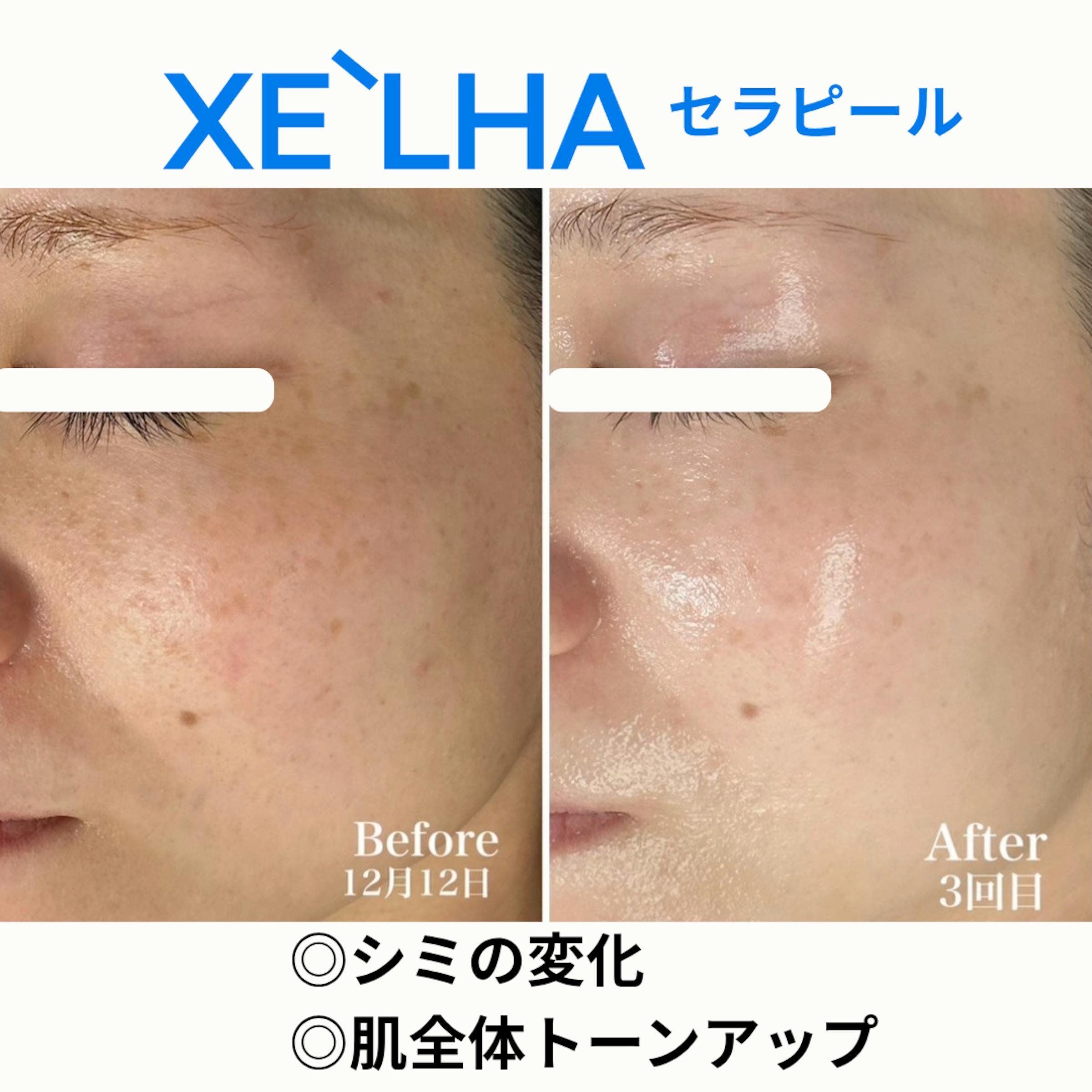 セラピール」とは – XE`LHA Japan
