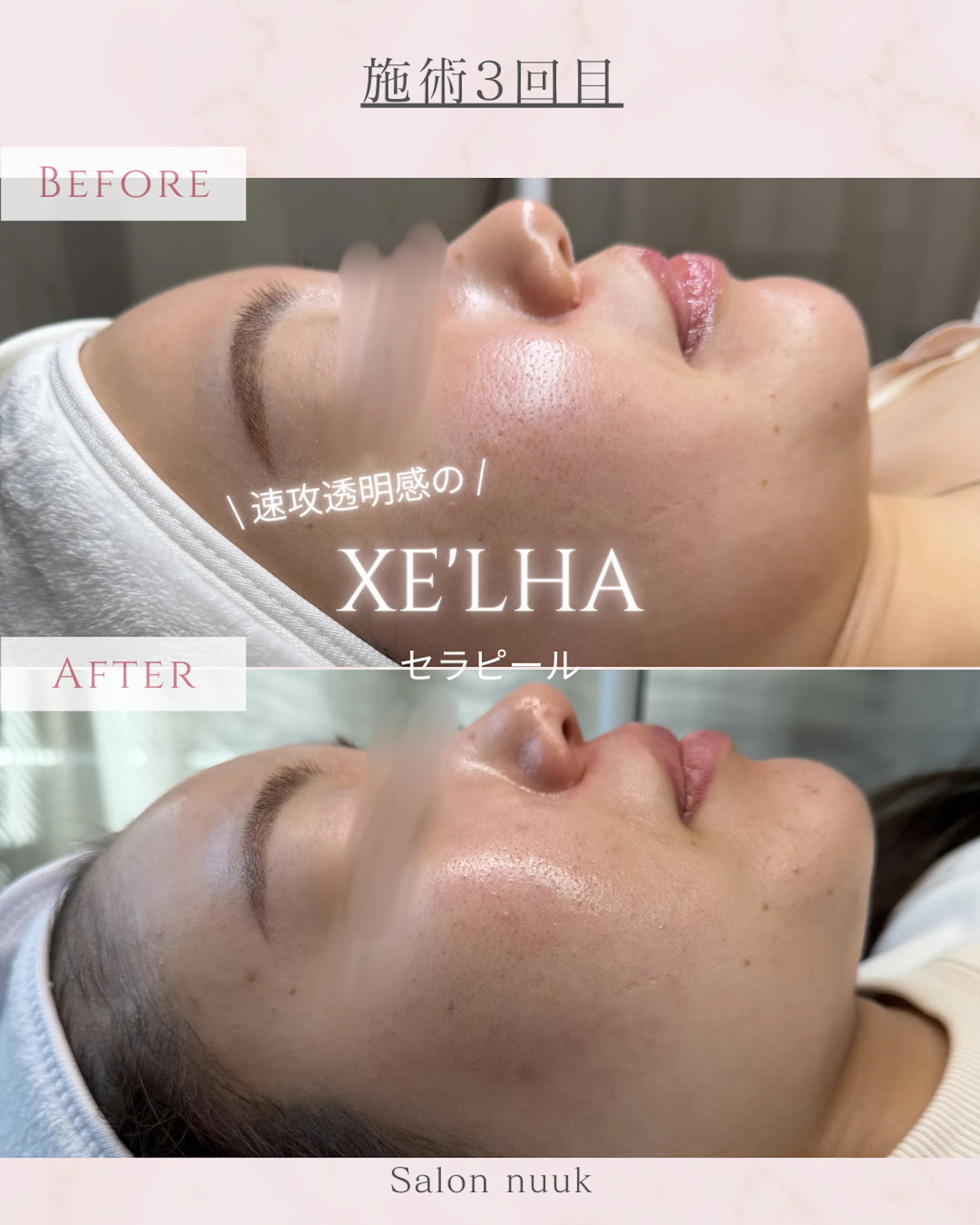 XE`LHA Japan｜セラピール日本公式
