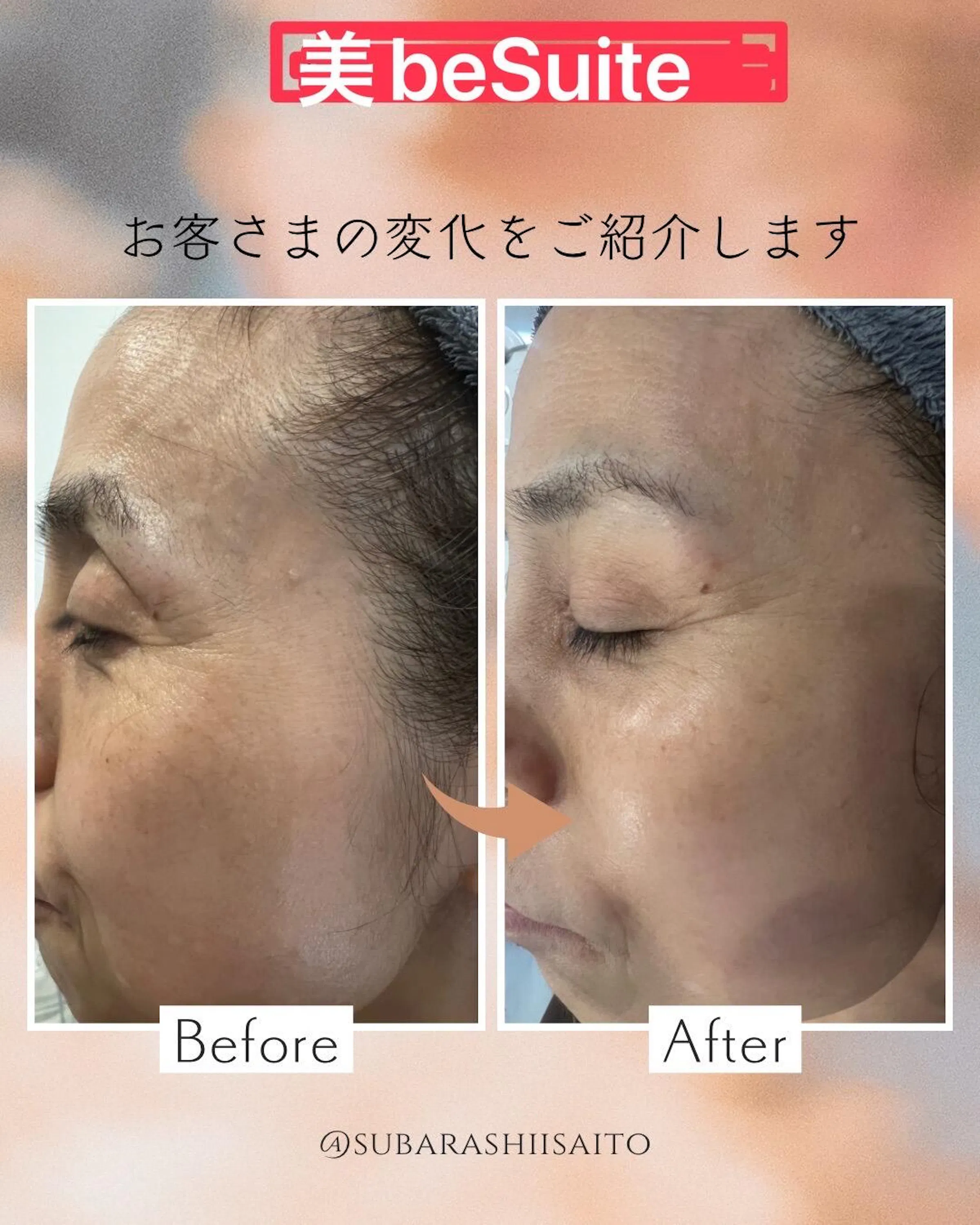 セラピール」とは – XE`LHA Japan