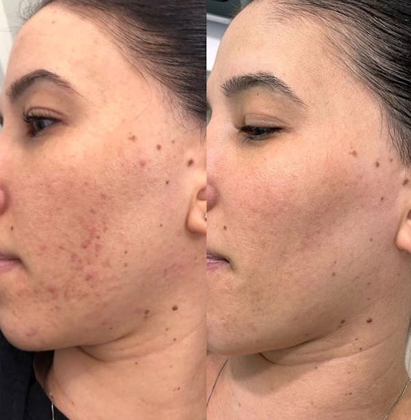 PACK ROZY + VAIOLET + CINTILLO OMG