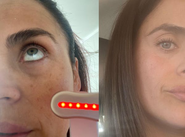 ISA ✨ VARITA MAGIC LED FACIAL